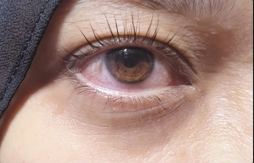 After lash lift, client example 1