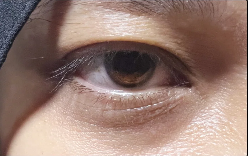 Before lash lift, client example 1