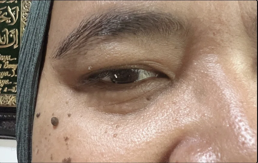 Before lash lift, client example 10