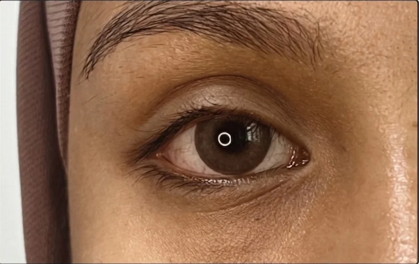 Before lash lift, client example 12