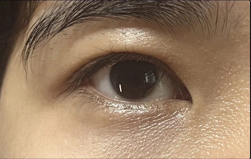 Before lash lift, client example 7
